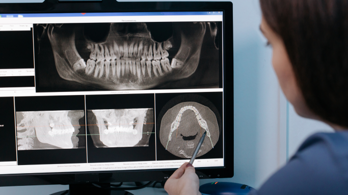 Mujer analizando radiografías dentales en una pantalla de ordenador.